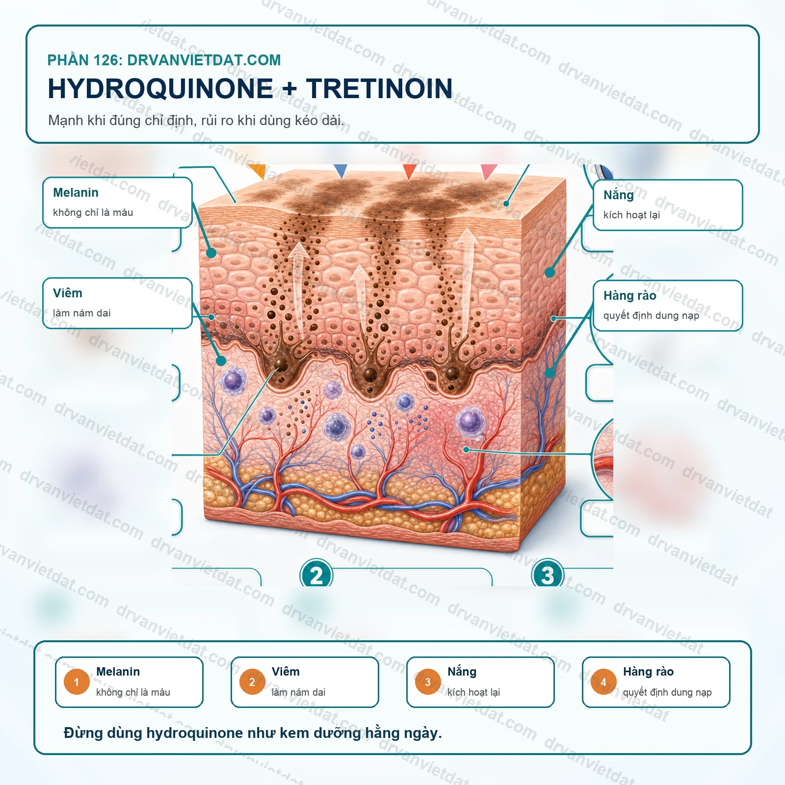 Phần 126: Hydroquinone và tretinoin trong nám: hiệu quả cao nhưng phải dùng có chiến lược
