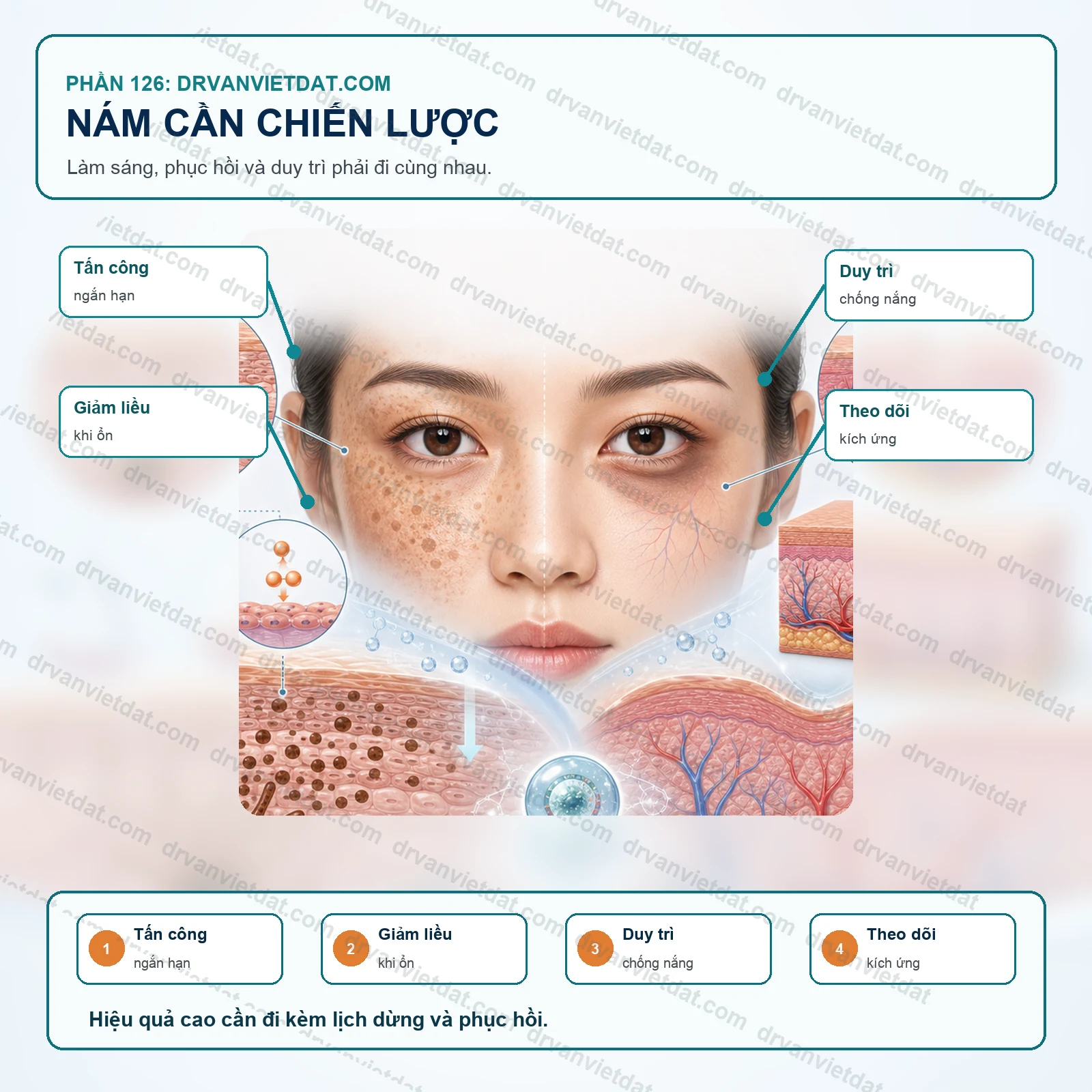 Phần 126: Hydroquinone và tretinoin trong nám: hiệu quả cao nhưng phải dùng có chiến lược
