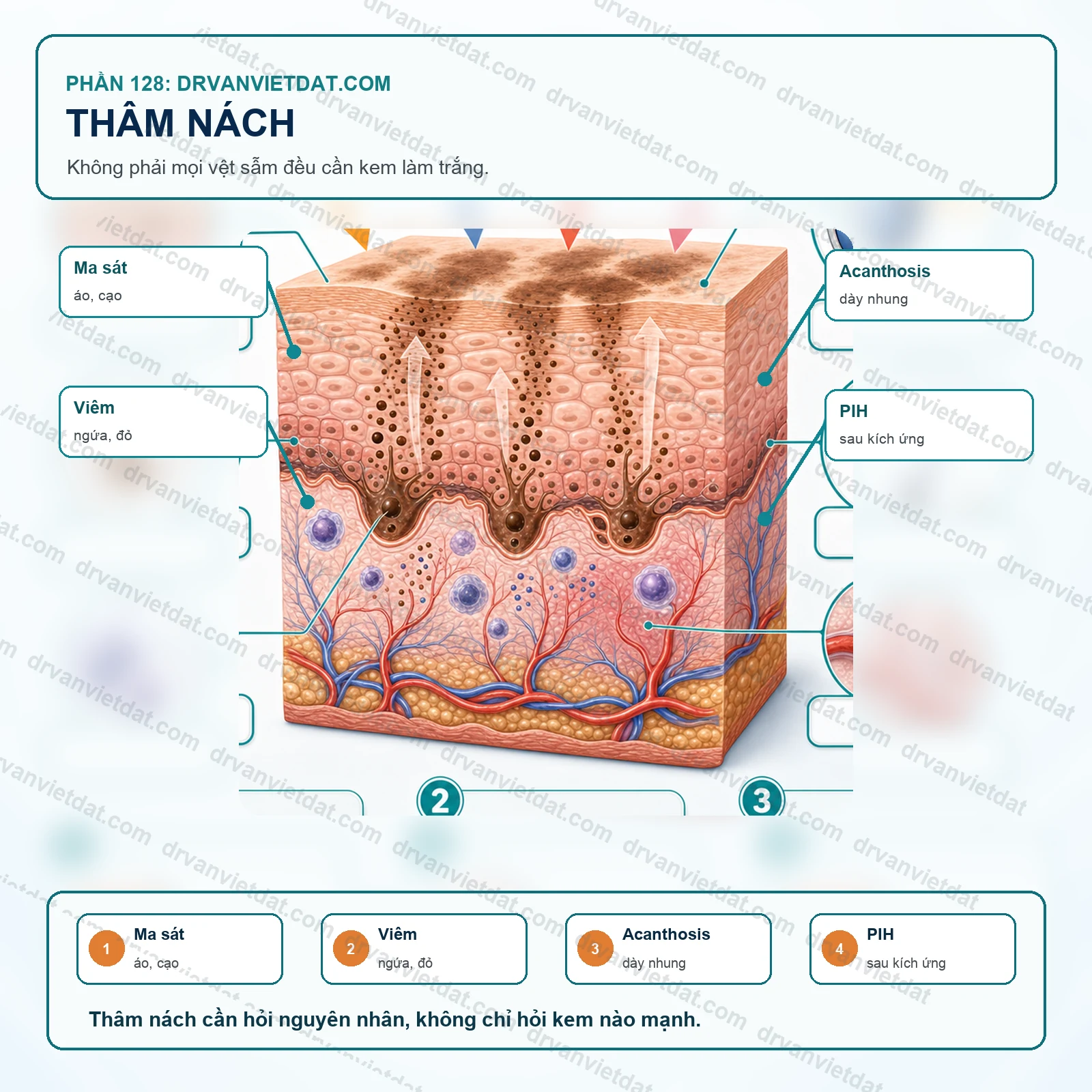 Phần 128: Thâm nách: phân biệt ma sát, viêm, sắc tố và bệnh nền trước khi bôi làm sáng