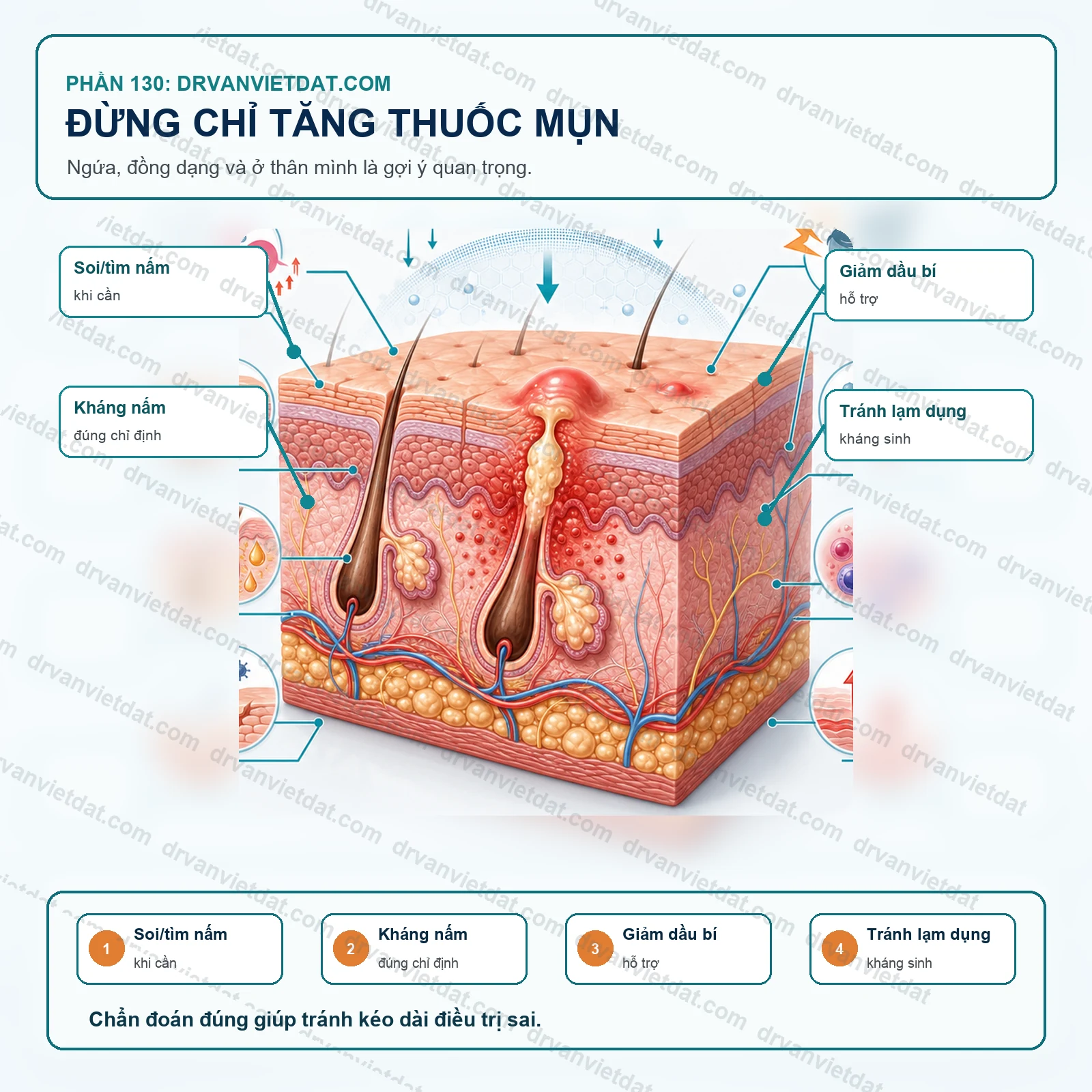 Phần 130: Viêm nang lông do Malassezia: dạng mụn ngứa dễ điều trị nhầm