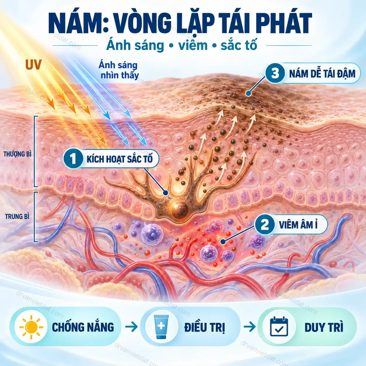 Infographic: Nám má và rối loạn sắc tố: điều trị phải đi cùng chống nắng và duy trì
