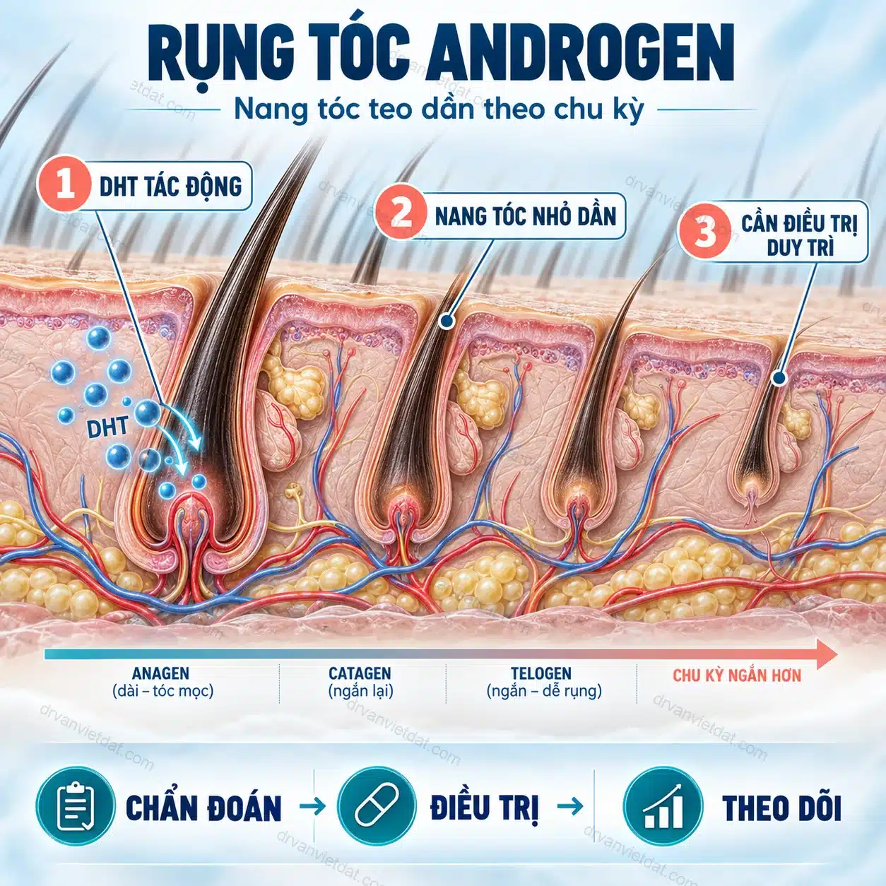 Infographic: Rụng tóc androgen: lựa chọn điều trị nào có bằng chứng?