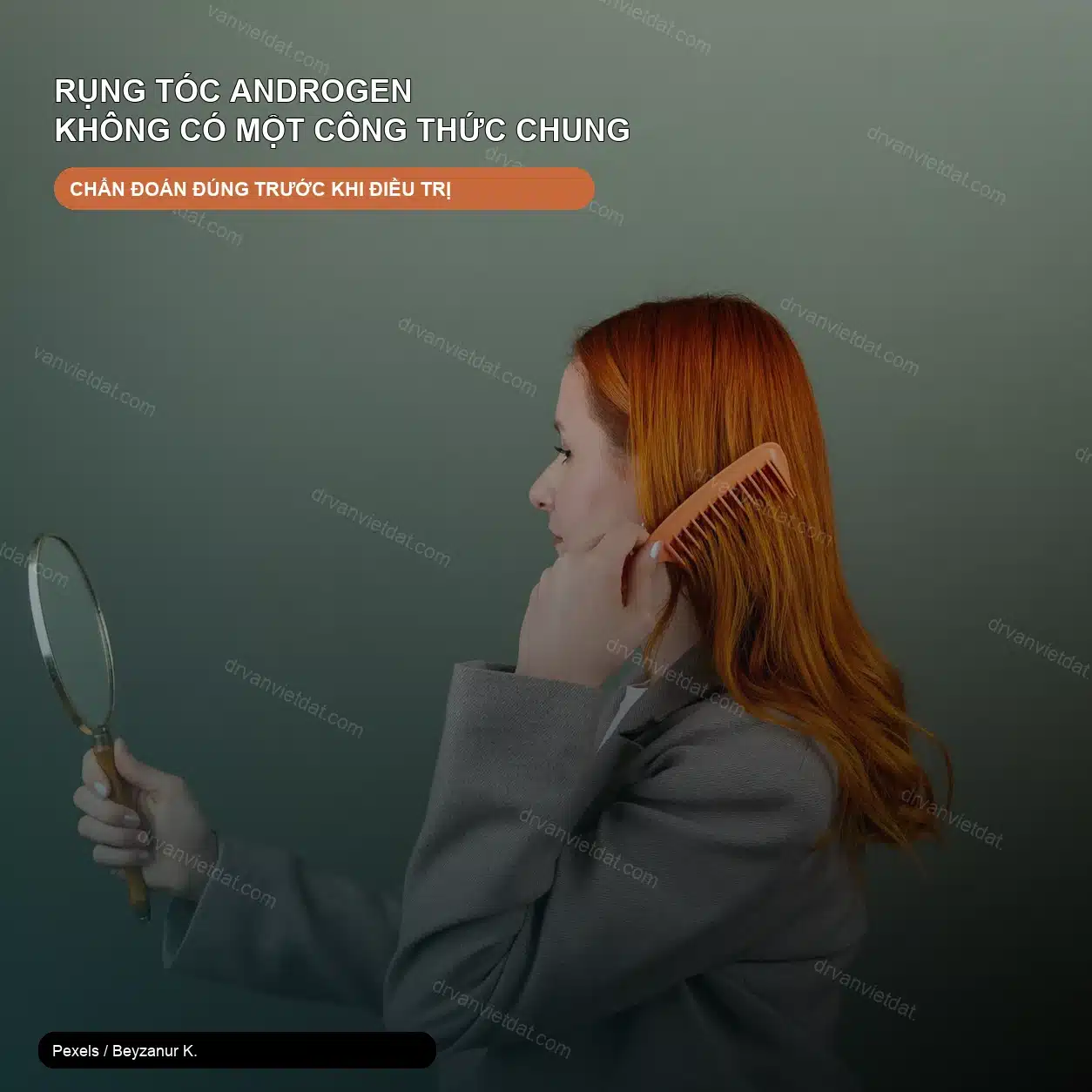 Rụng tóc androgen: lựa chọn điều trị nào có bằng chứng? – ảnh thật thiết kế