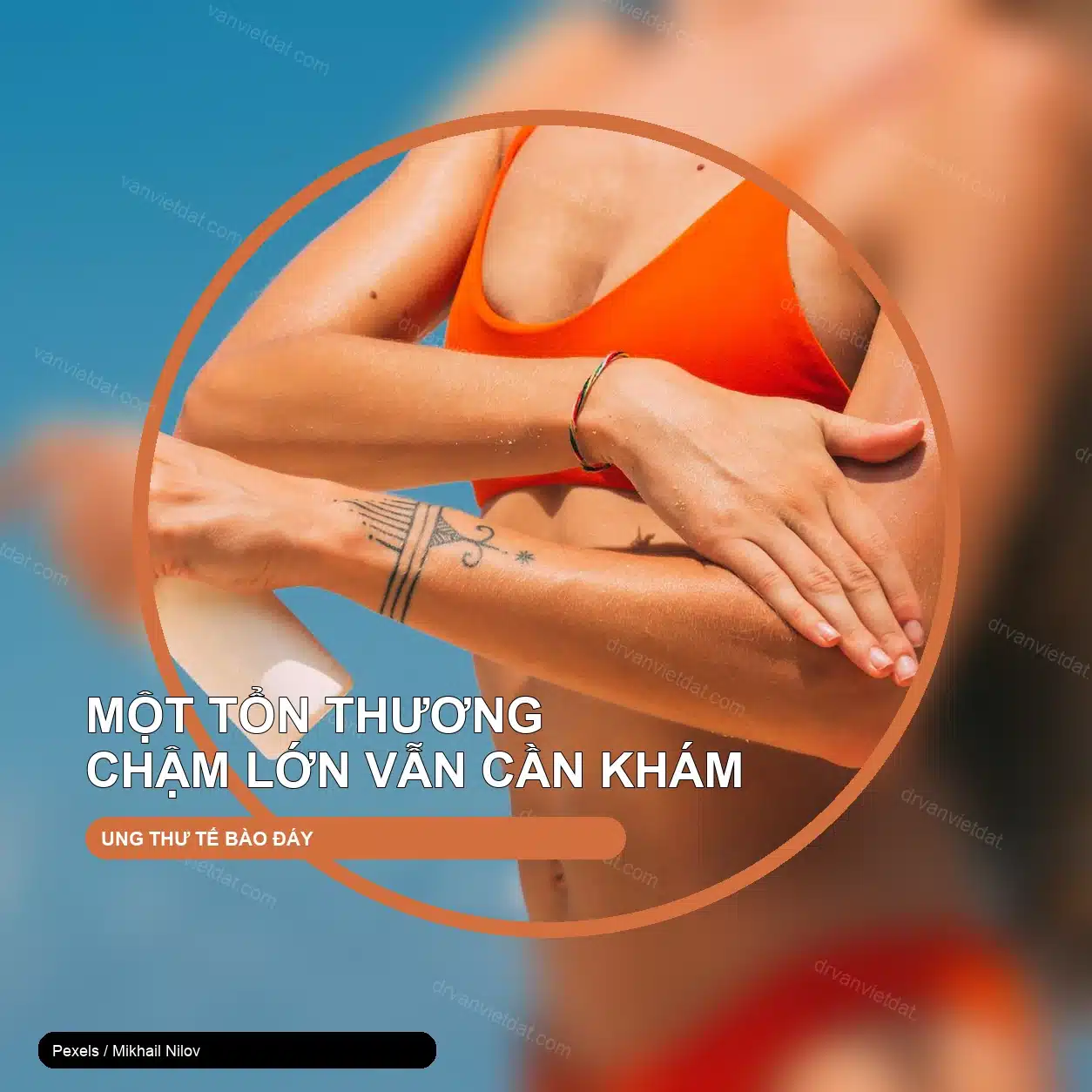 Ung thư tế bào đáy: tổn thương da chậm lớn nhưng không nên xem nhẹ – ảnh thật thiết kế