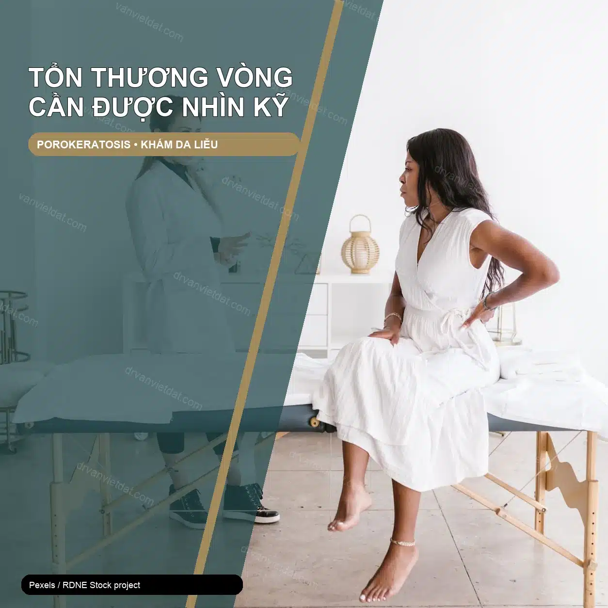 Porokeratosis: nhận diện tổn thương vòng và lý do cần theo dõi – ảnh thật thiết kế