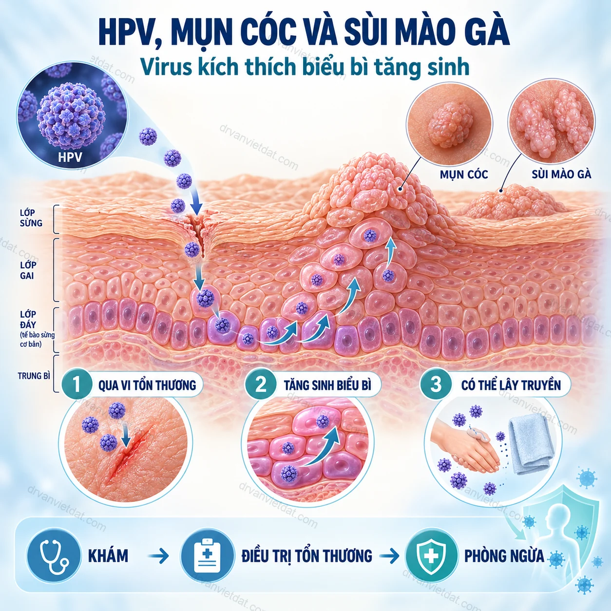 Infographic: HPV, mụn cóc và sùi mào gà: khi nào cần khám?