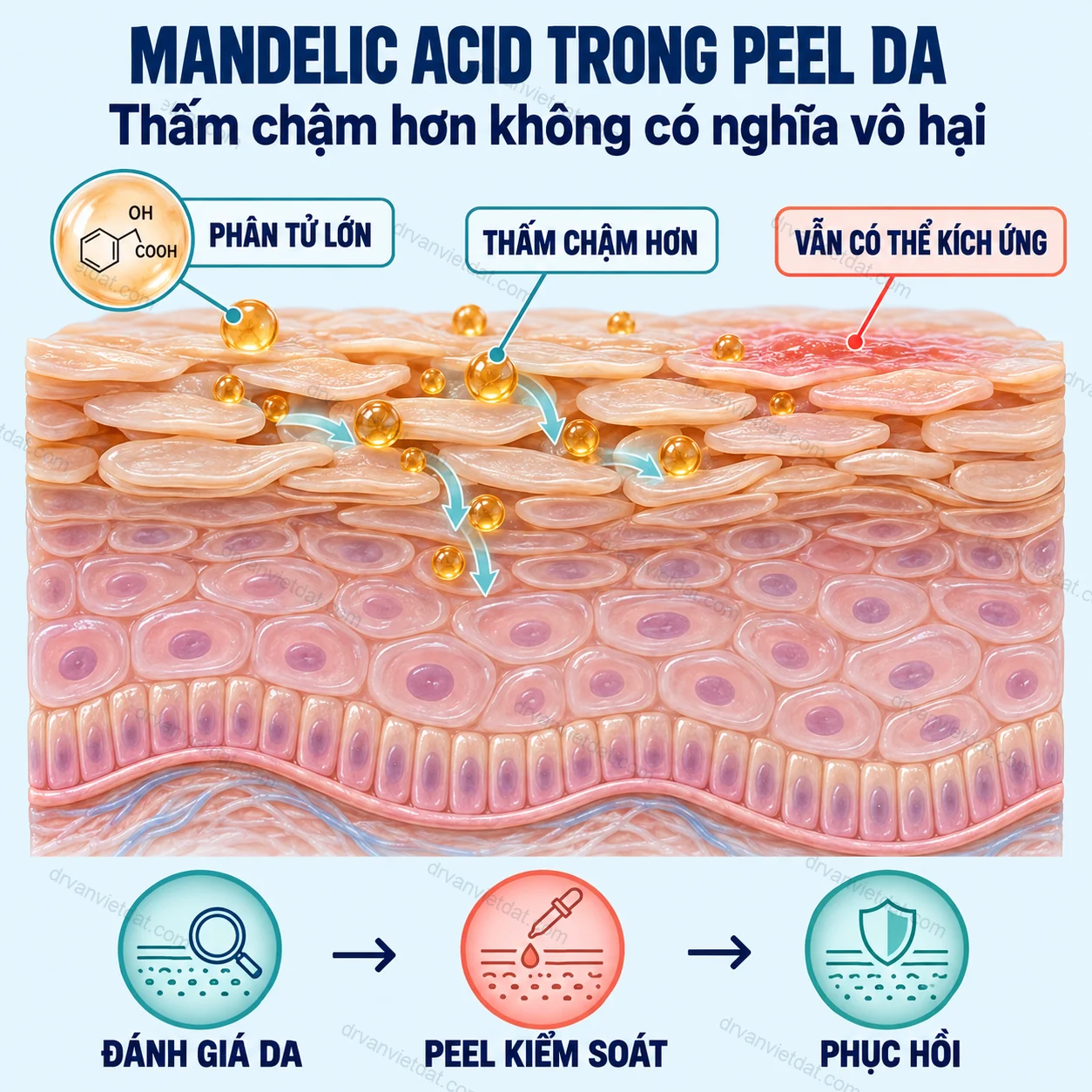 Infographic: Mandelic acid trong peel da: dịu hơn có đồng nghĩa an toàn hơn?