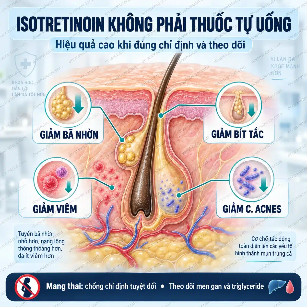 Infographic cơ chế isotretinoin tác động lên tuyến bã và quá trình hình thành mụn