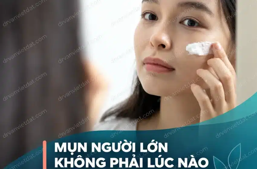 Hình minh họa phụ nữ trưởng thành chăm sóc da có mụn vùng cằm và đường hàm