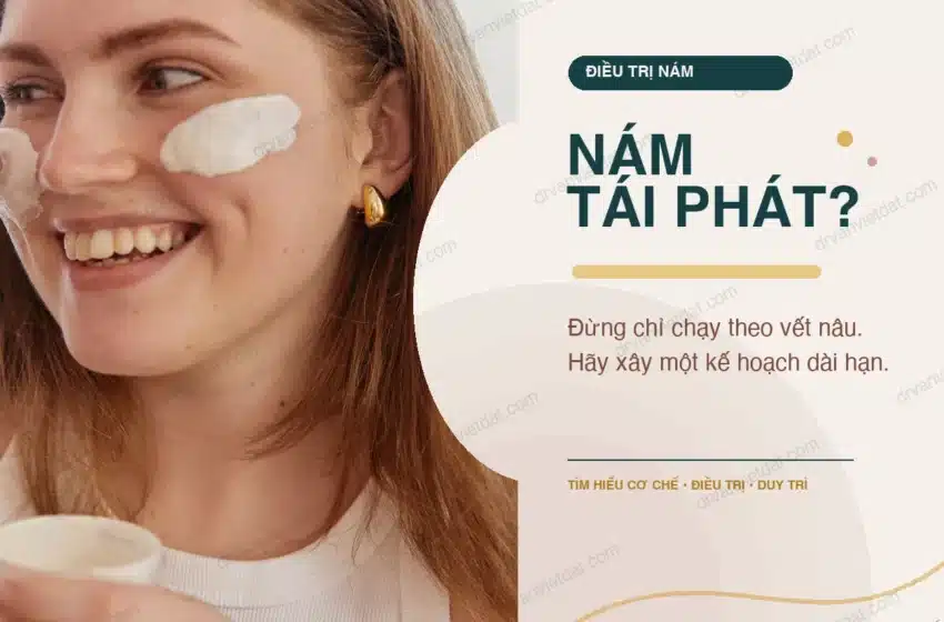  ĐIỀU TRỊ NÁM ĐÚNG CÁCH: Vì sao nám cứ tái phát?
