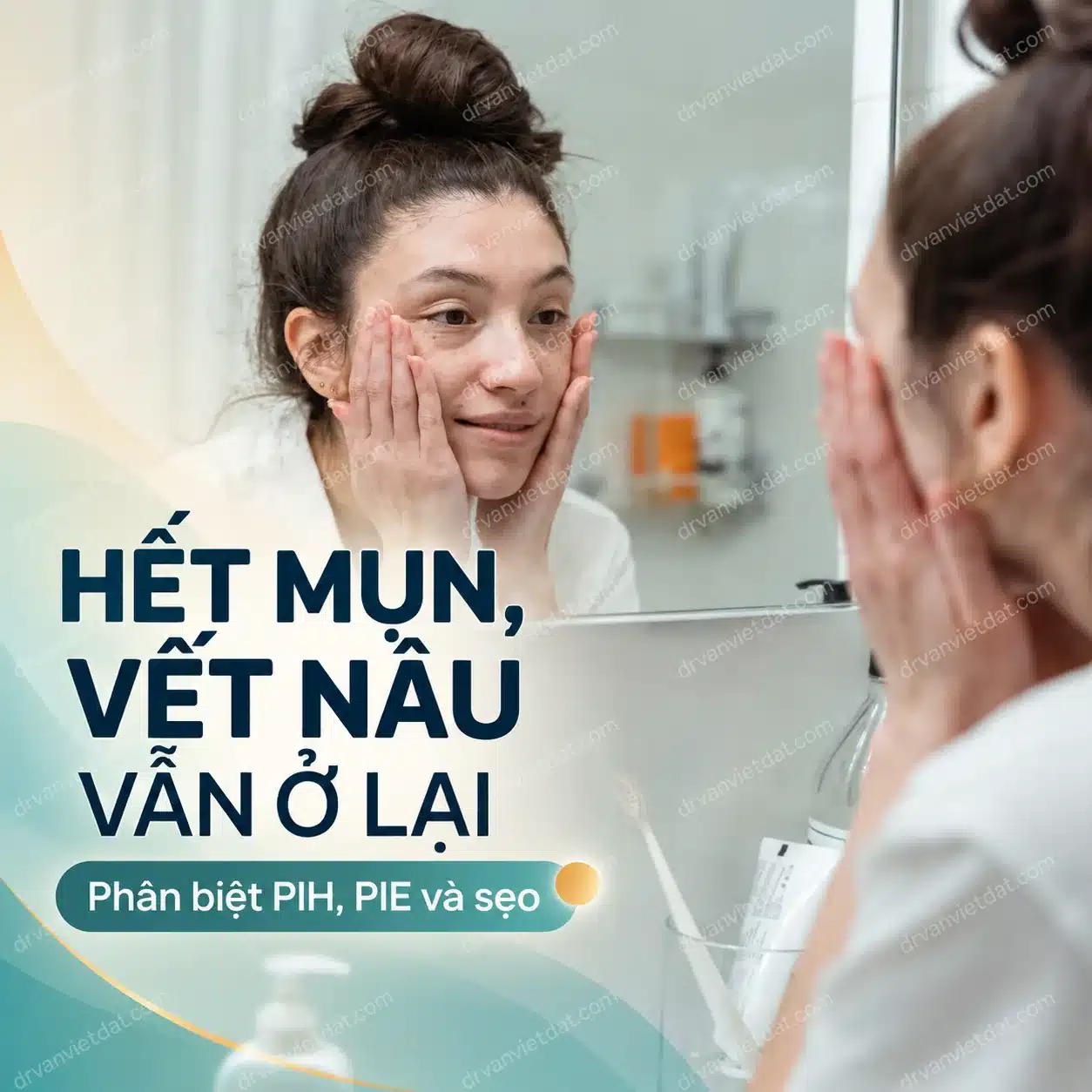 Hình minh họa người phụ nữ quan sát dấu đỏ và nâu sau mụn trước gương