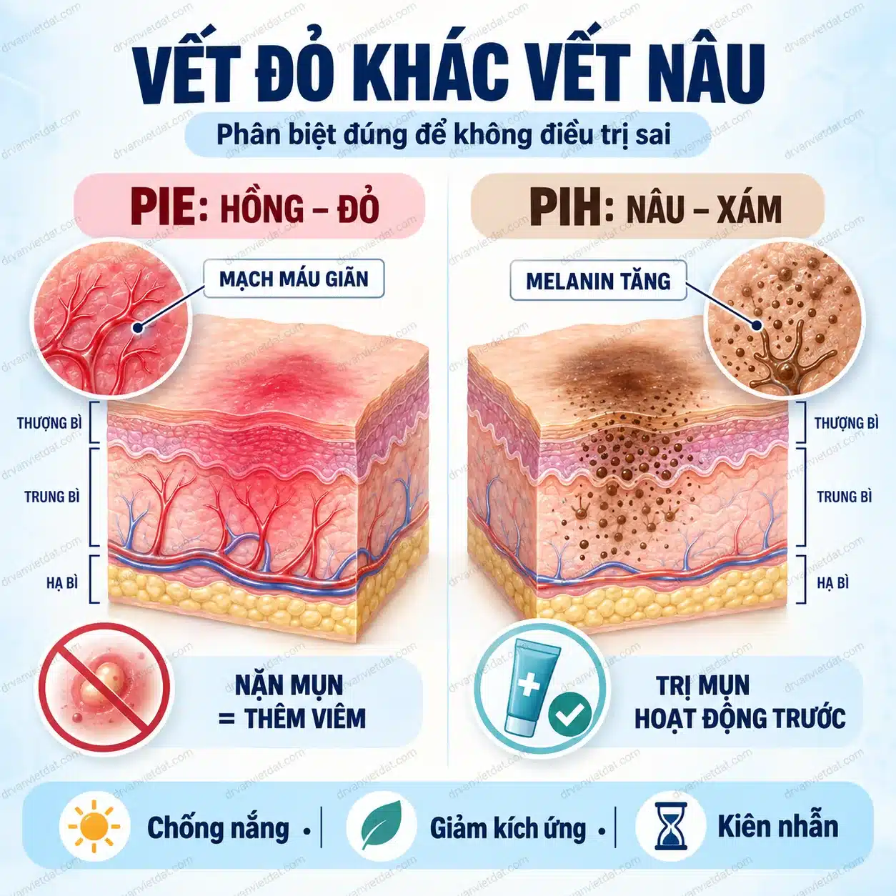 Infographic phân biệt vết đỏ PIE vết nâu PIH và sẹo sau mụn